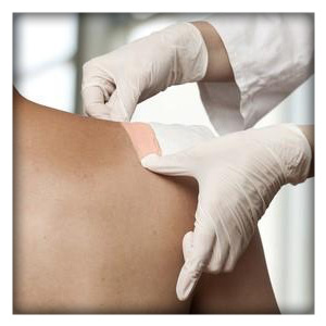 Medical Adhesives Wound Dressings