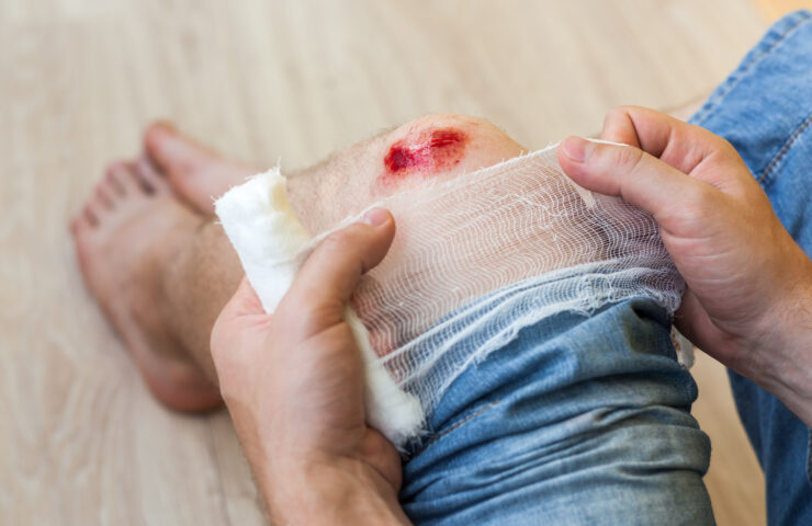 How to Prepare your Skin for Wound Dressing